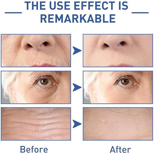 SADOER Retinol Caffeine Anti-Wrinkle Eye Cream